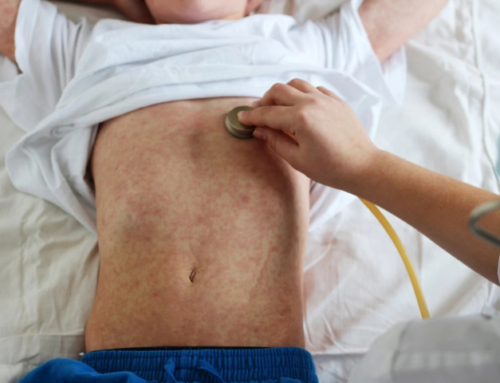 Eye-Popping WHO Report Shows Measles Surging Across the Globe