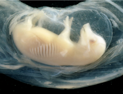 Tiny Human Hearts Grown In Pig Embryos For The First Time