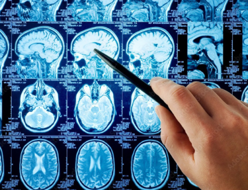 Can This Nasal Spray Slow Down Alzheimer’s? One Couple Is Helping Scientists Find Out