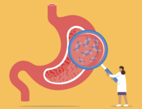 Would You Remove a Healthy Organ to Prevent Disease?