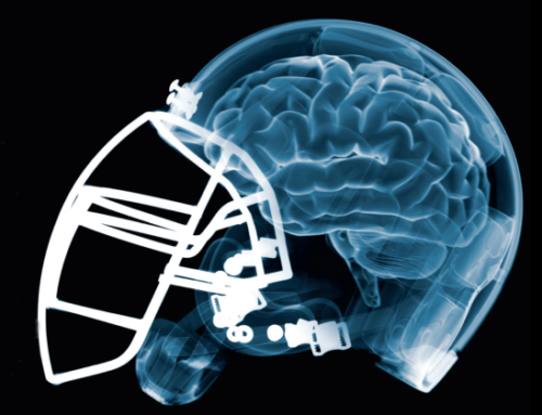 New Study Finds CTE in at Least One in Four Former NFL Players